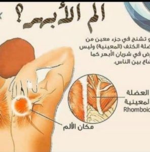 طق الابهر بالرياض